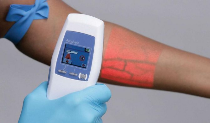 dispositifs médicaux avec rayons infrarouges